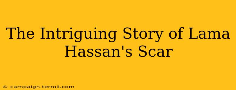 The Intriguing Story of Lama Hassan's Scar