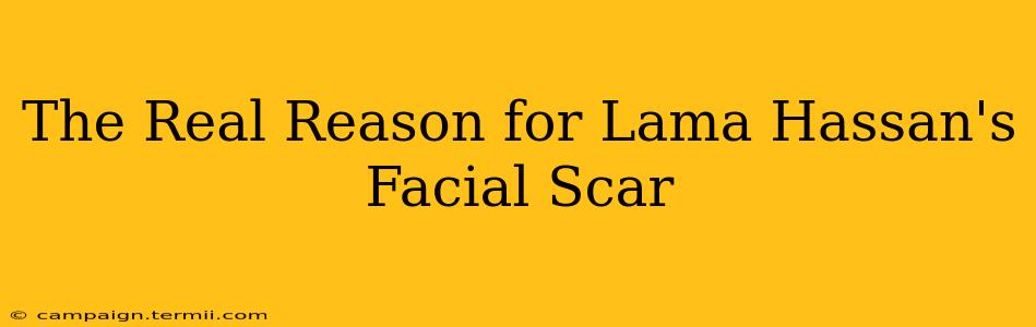 The Real Reason for Lama Hassan's Facial Scar