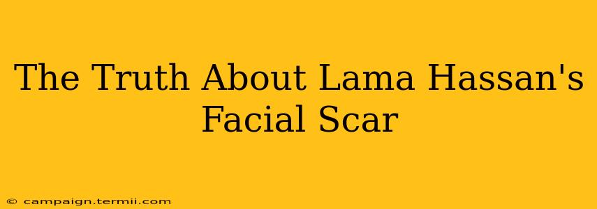 The Truth About Lama Hassan's Facial Scar