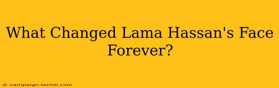 What Changed Lama Hassan's Face Forever?